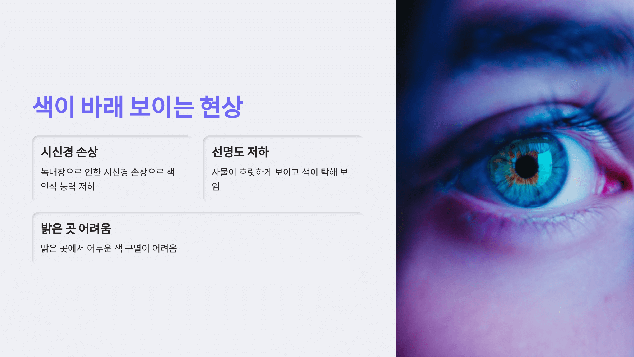 녹내장과 관련된 사진입니다.