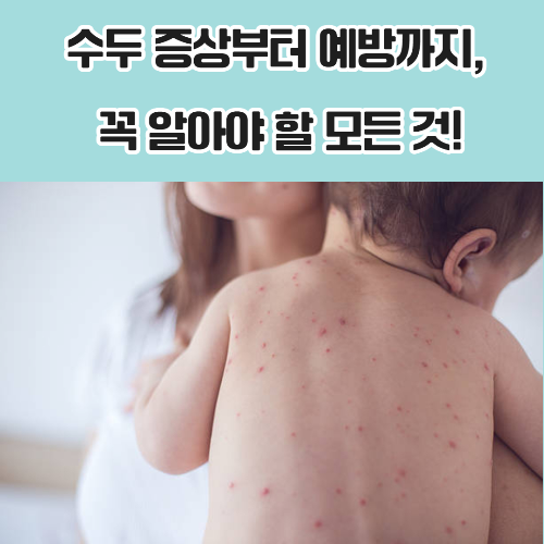 수두 증상부터 예방까지, 꼭 알아야 할 모든 것!