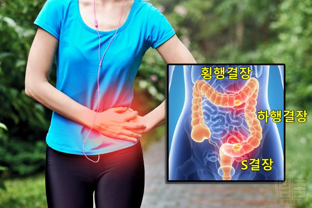 대장암 전조증상 4기 대장암증상 배 왼쪽 통증