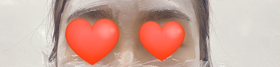 스킨보톡스 후기