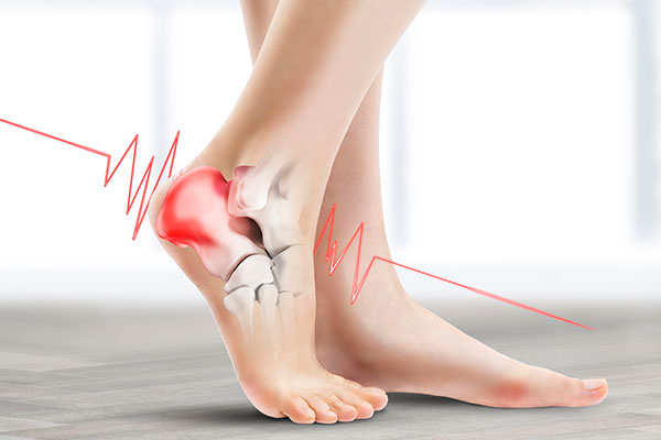 발뒤꿈치가_아픈_이유