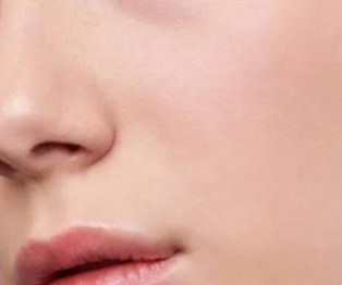 피부 개선