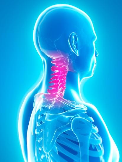 뼈의 비정상적 성장: 골극(Bone Spur)이란?