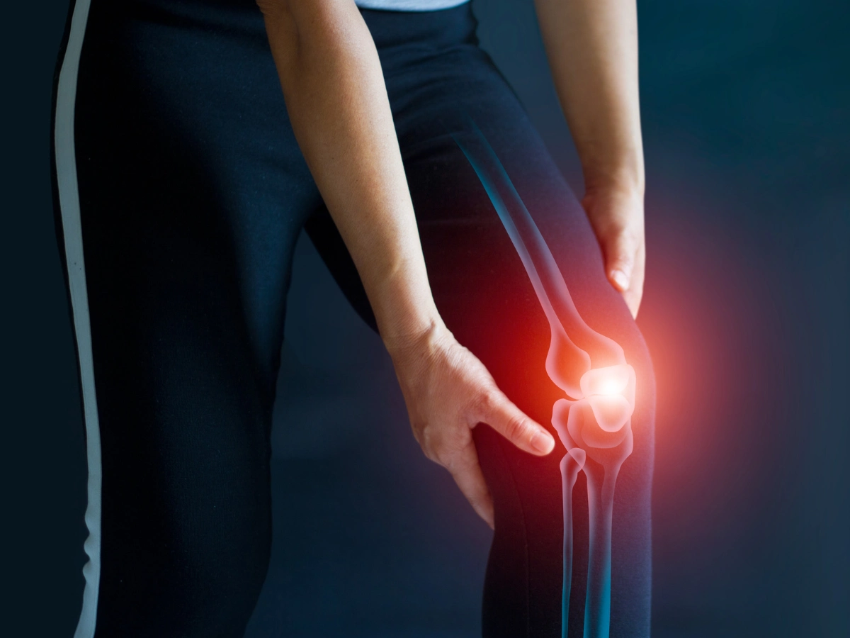 보스웰리아 효능 관절 통증 개선