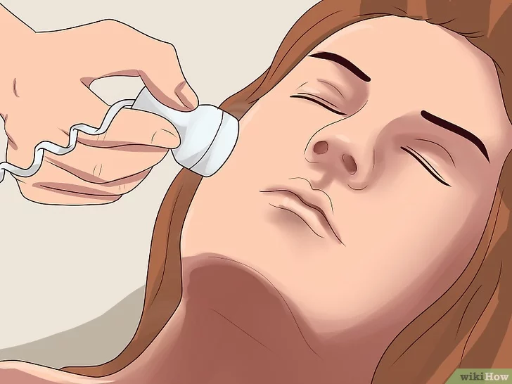 기미 잡티 제거