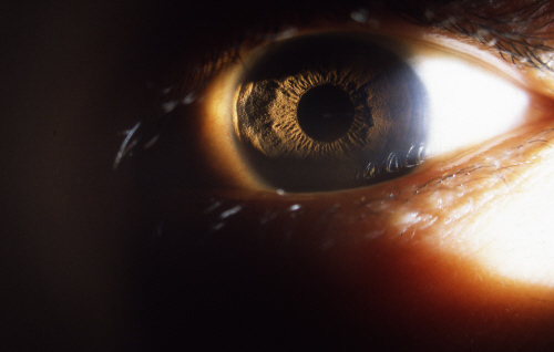 차전자피 효능 먹는법 부작용 (2주 섭취 후기)