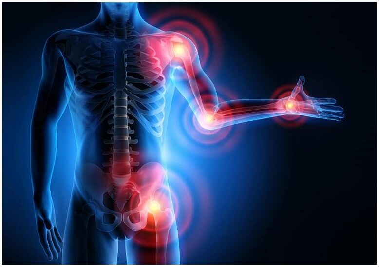 염증에 좋은 음식과 나쁜 음식