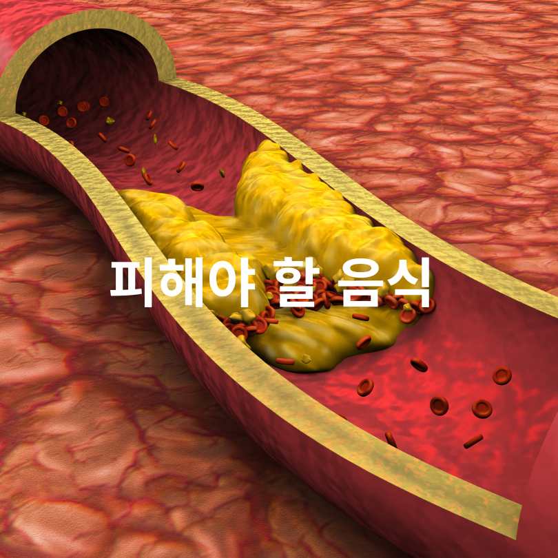 LDL 콜레스테롤 낮추는 음식