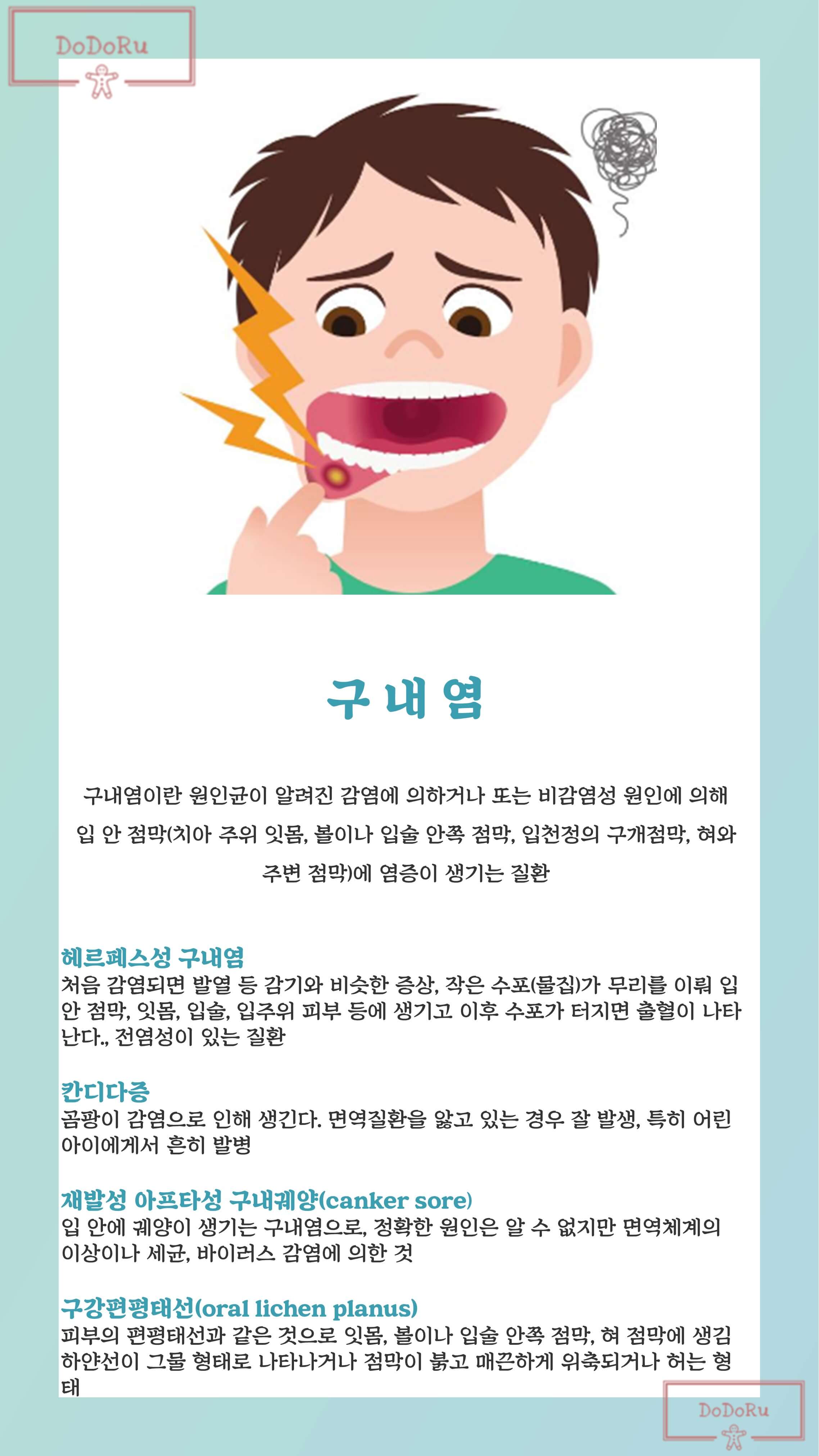 구내염-증상
