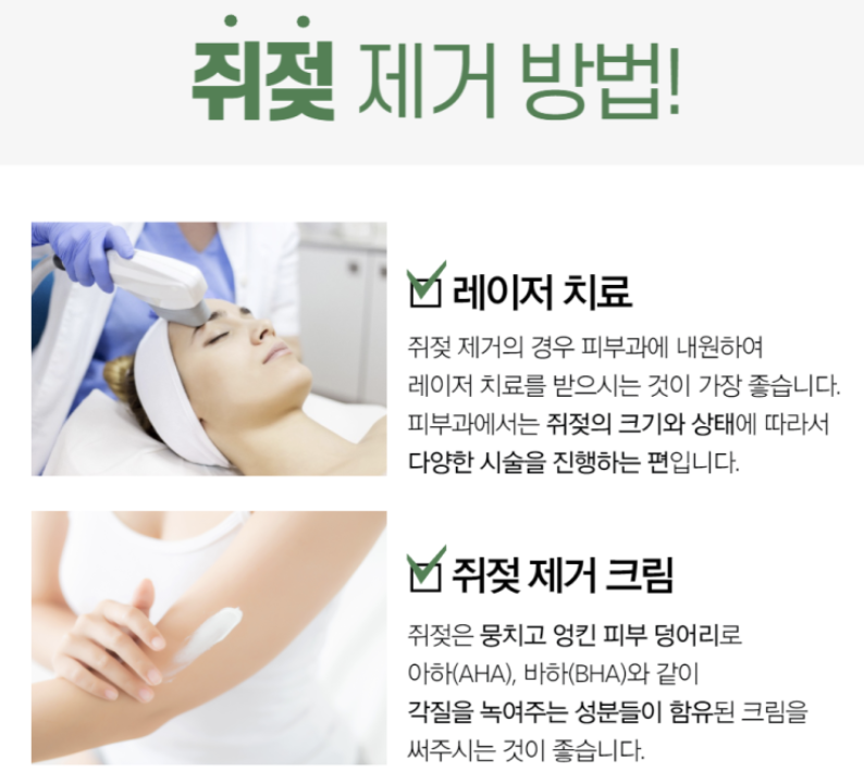 쥐젖 제거방법 1