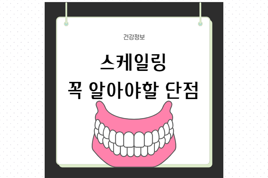 스케일링-꼭-알아야할-단점