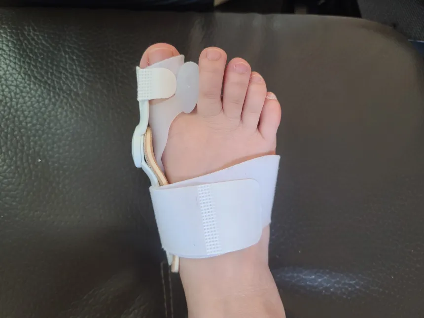 무지외반증 교정기