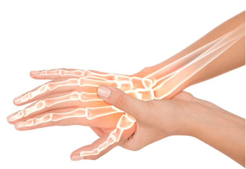 손가락-관절염-초기증상