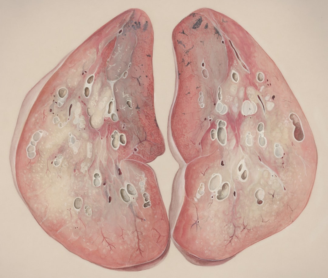 Liver.