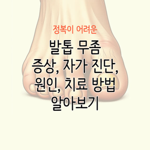 발톱-무좀-증상-원인-치료-방법