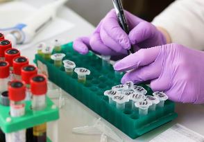 대장내시경 전 음식