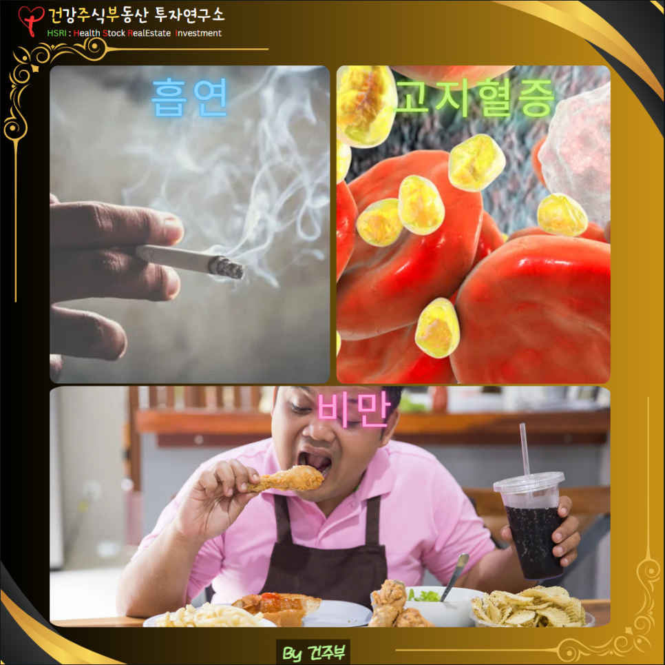 심근경색 원인과 치료방법
(글 그림 : 건주부, 그림 출처 : Canva)