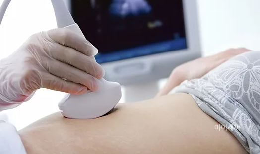 담낭 용종 초음파