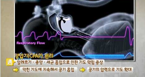 양압기 원리