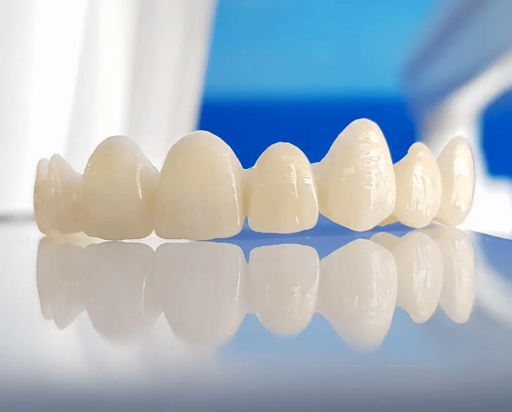 앞니 지르코니아