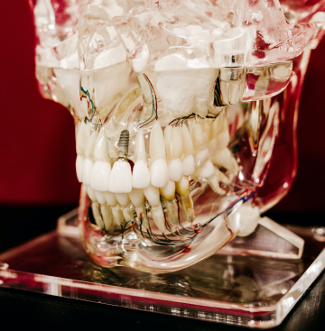 라미네이트 부작용