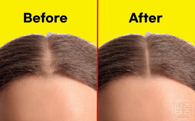 머리숱 많아지는 음식 탈모에 좋은 영양소