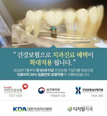 임플란트 지원 대상 건강보험 적용 연령 비용 안내_15