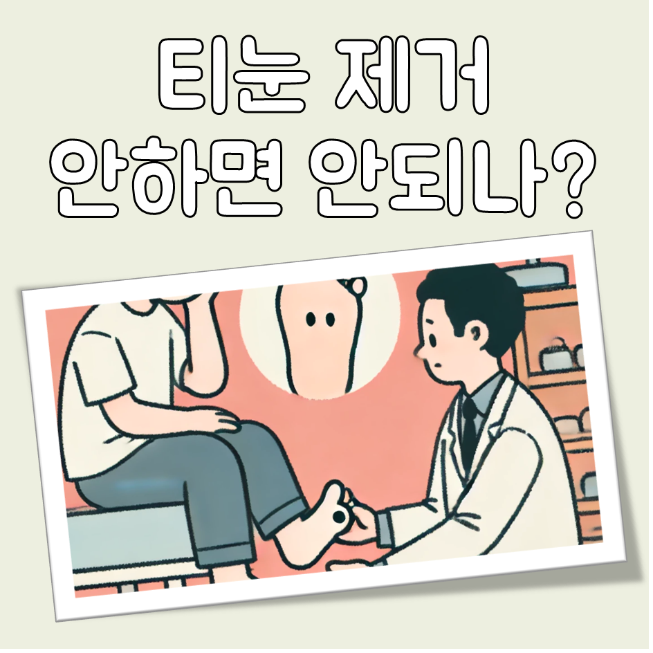 티눈 제거 대표 이미지