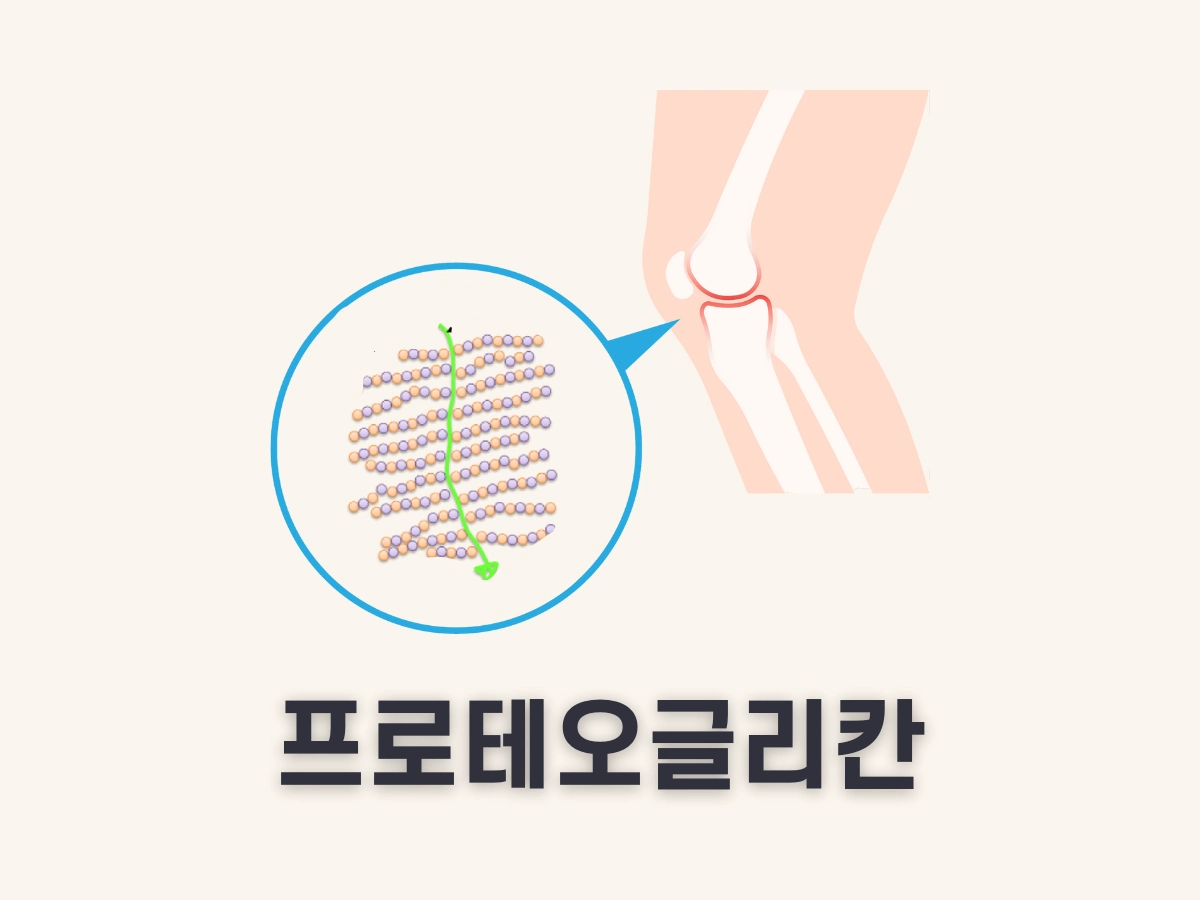 프로테오글리칸