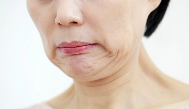 안면마비 전조증상 6가지