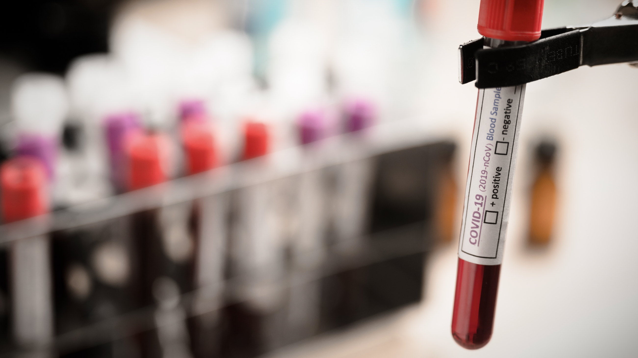 혈액 검사 (Blood Tests)