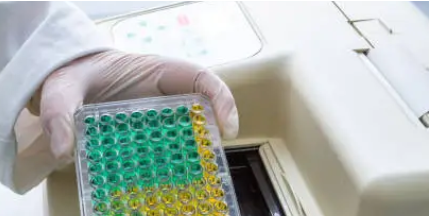 ICH M10 가이드라인에 따른 바이오분석법 밸리데이션 사례와 국내외 실무 적용 차이