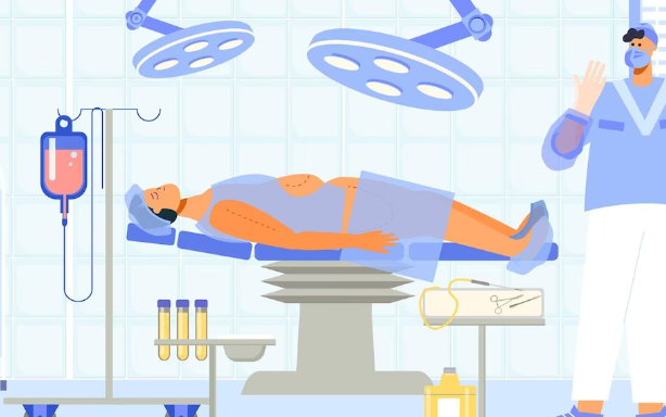 비만대사 수술의 종류 소매 위 절제술