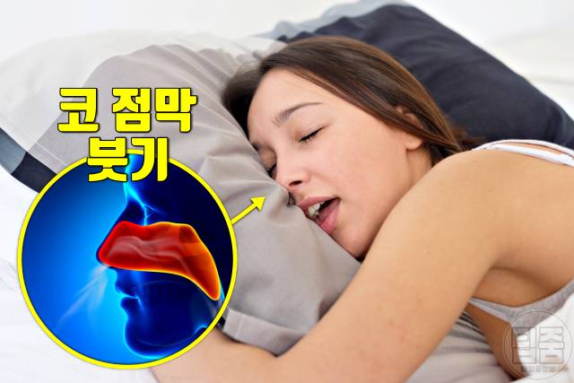 과로증상 피곤하면 코고는 이유 혈뇨 쌍커풀 입술물집 귀가멍멍 코피 두드러기