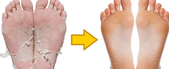 효과 및 성분은? 