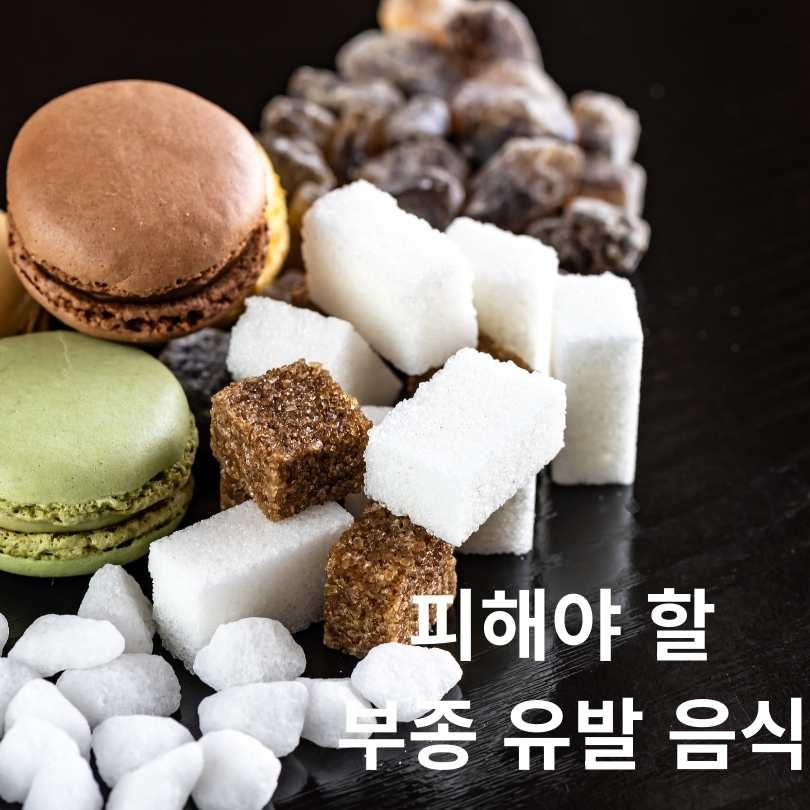 하루 5분! 부종 빼는 음식과 부종 빼는 습관