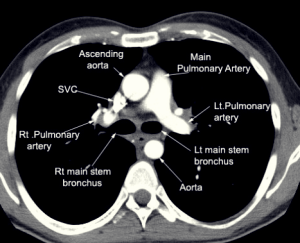 파주 흉부외과 의원과 진료시간