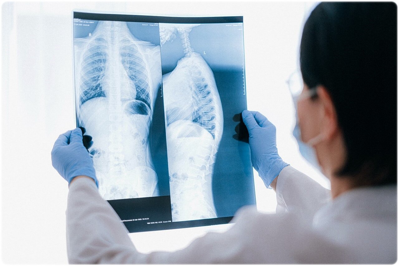 기관지 확장증 증상 원인 치료 관리 예방 방법