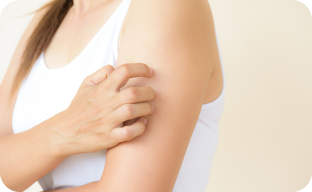 #교보 #교보생명 #환절기 #피부질환 #아토피 #건선 #피부과 #가려움증 #피부건조증 #피부병