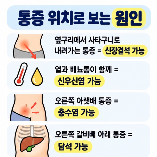 옆구리에서 사타구니로 번지는 통증은 신장결석, 발열과 배뇨통이 함께 있으면 신우신염, 오른쪽 아랫배 통증은 충수염을 의심할 수 있음을 정리한 카드