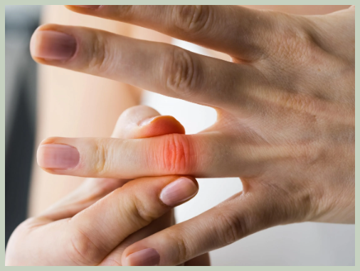 방아쇠 수지 증후군 증상