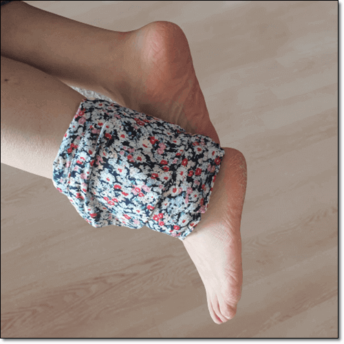 발목 접질렀을때