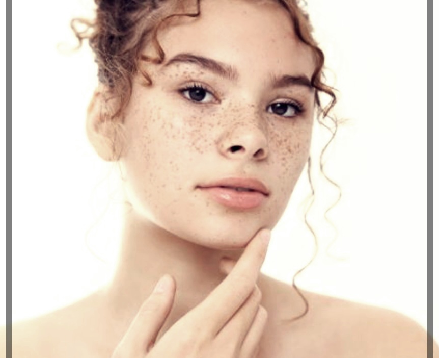 후천성 오타모반 이란?기미. 주금깨 주범.