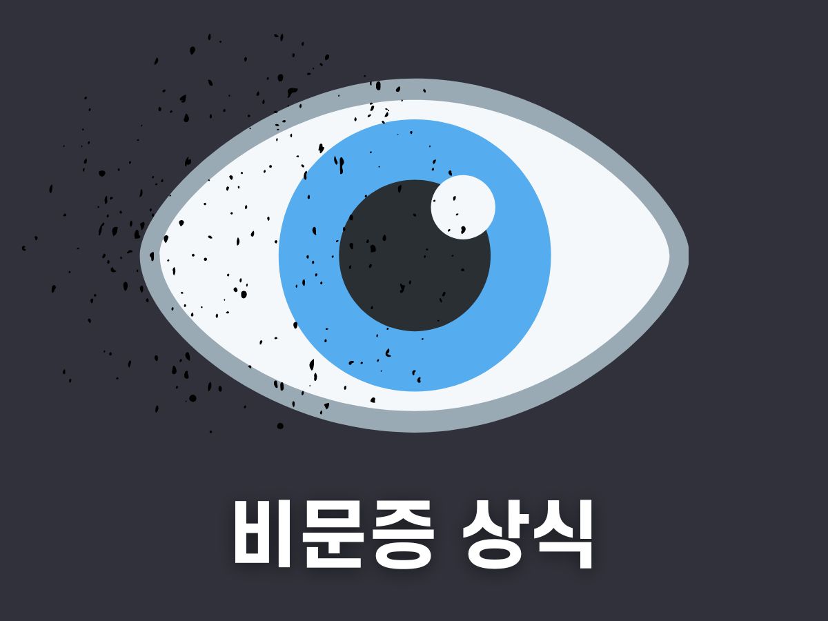 비문증 상식