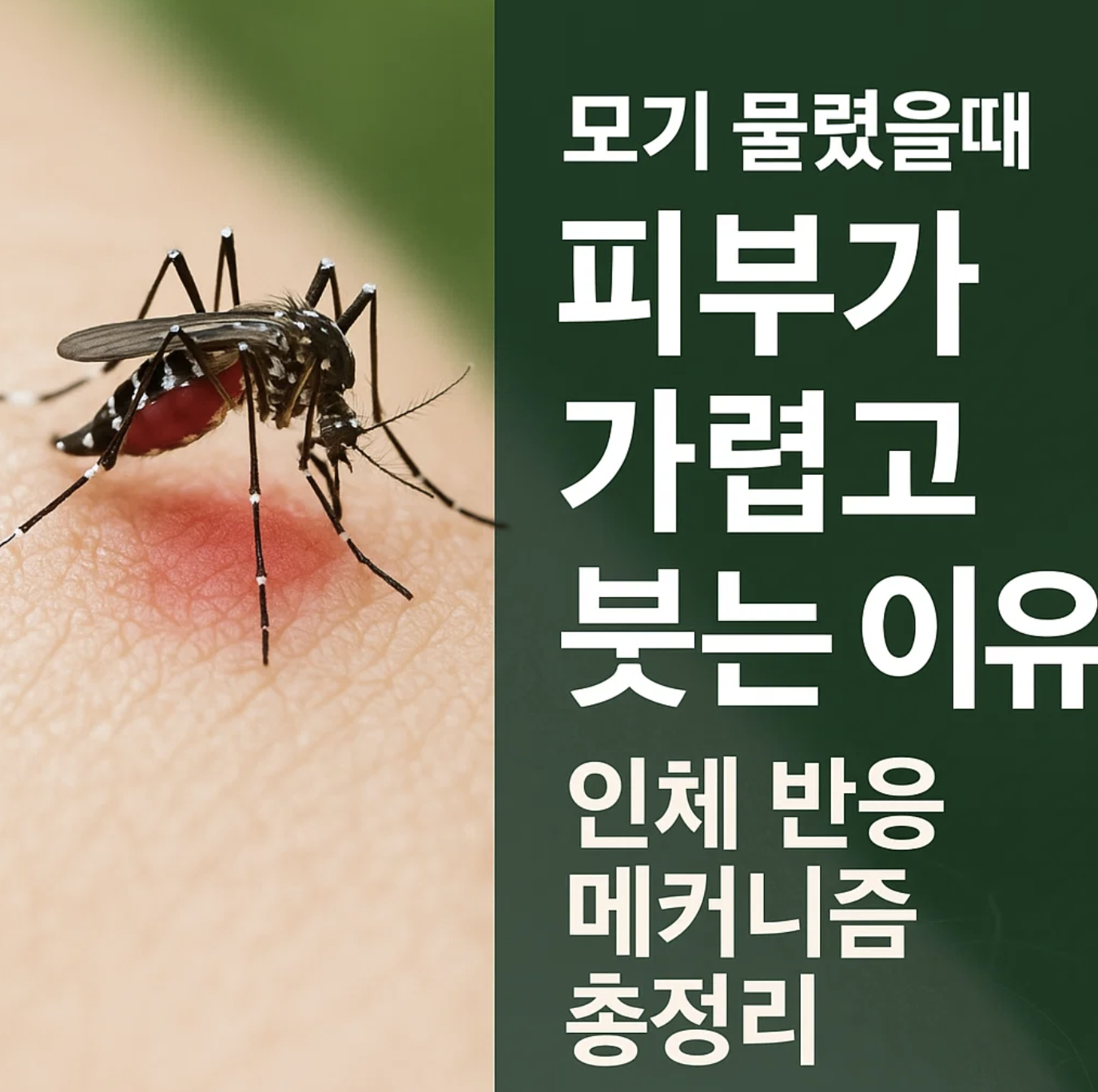 모기물렸을때 피부가 가렵고 붓는 이유, 인체 반응 메커니즘 총정리