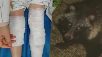 야생 너구리 도시 특징 매력 성격_22