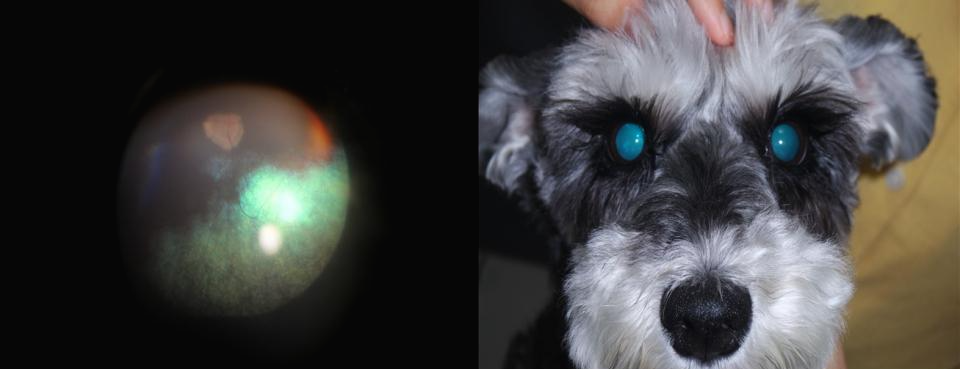 인실리코젠 프로젝트, 망막 위축증