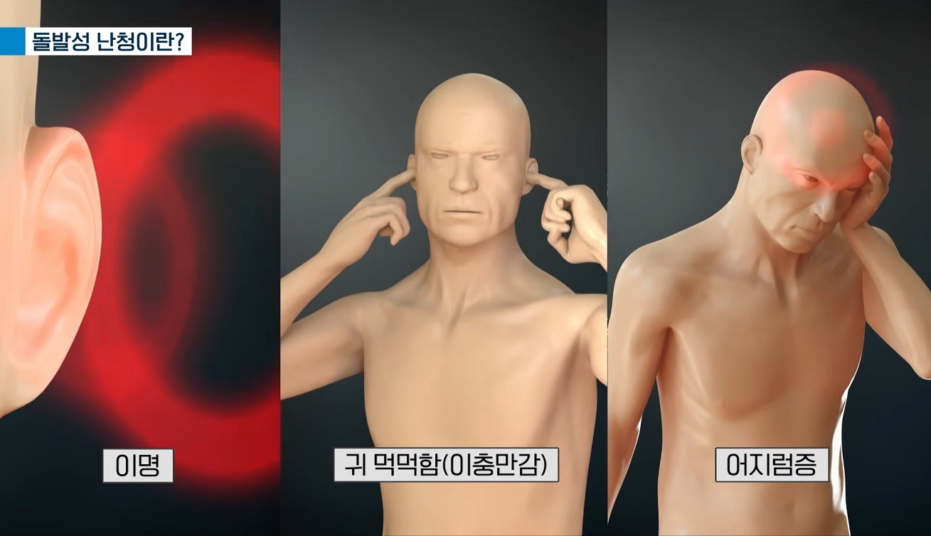 명의-난청-이비인후과-임기정-교수