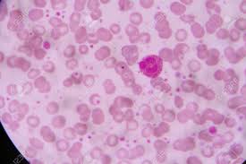 백혈구 정상수치 