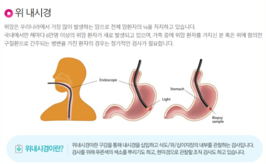 위내시경 관련 사진